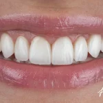The Dental Center Emergency Protocol That Saves Teeth