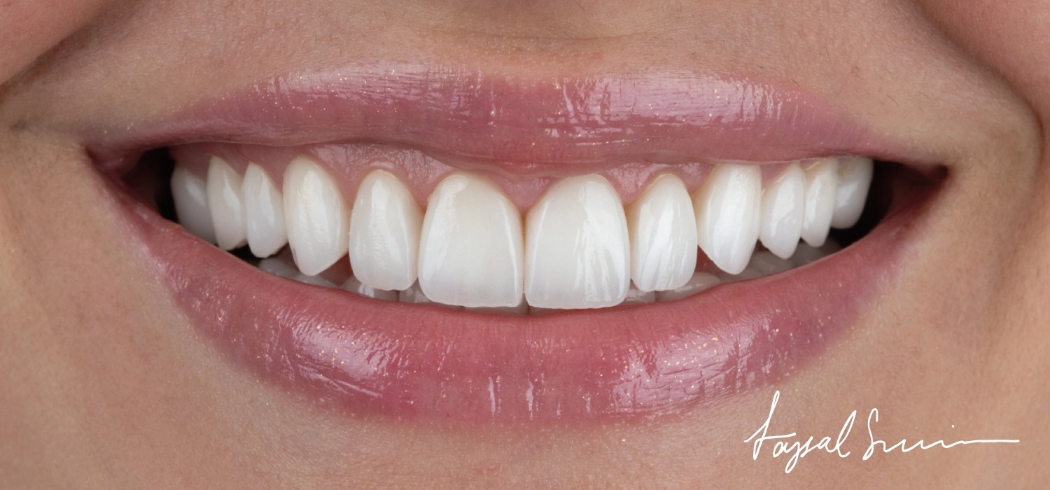 The Dental Center Emergency Protocol That Saves Teeth